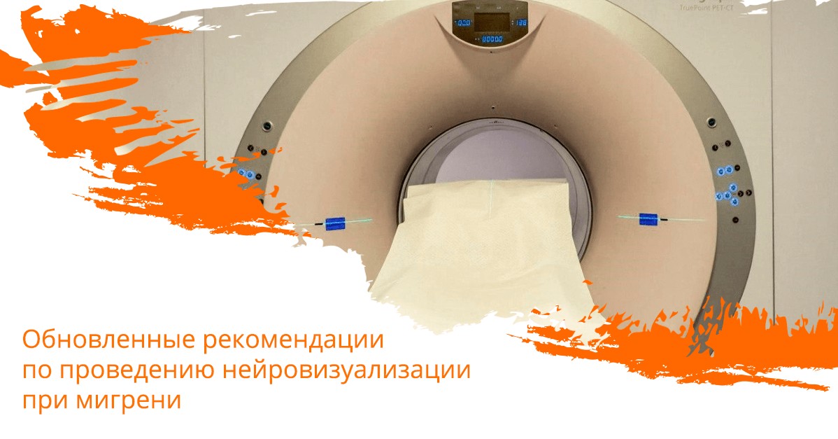 Обновленные рекомендации по проведению нейровизуализации при мигрени