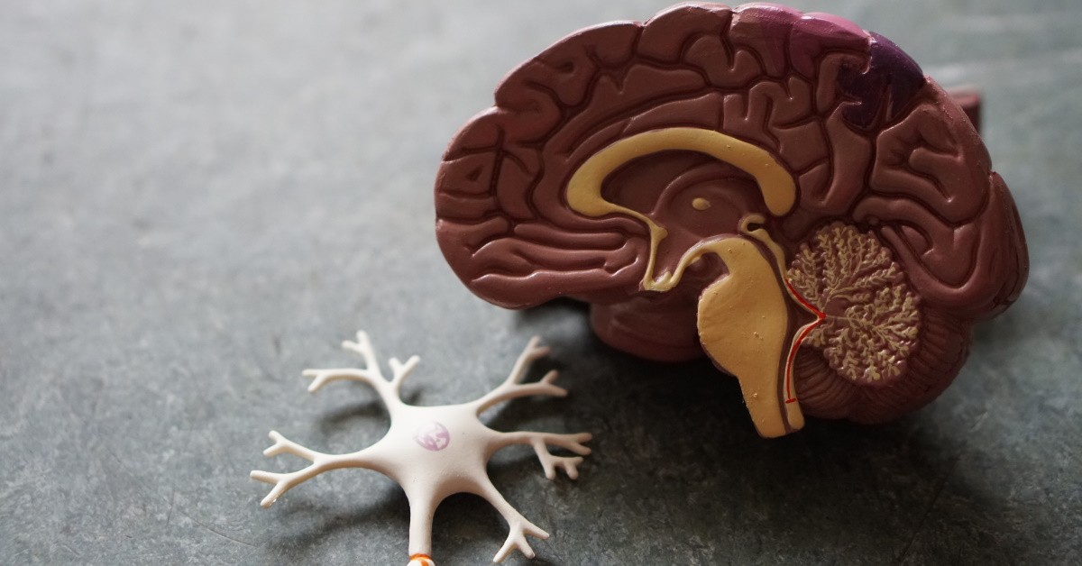 СОВРЕМЕННЫЕ АСПЕКТЫ диагностики и лечения деменции